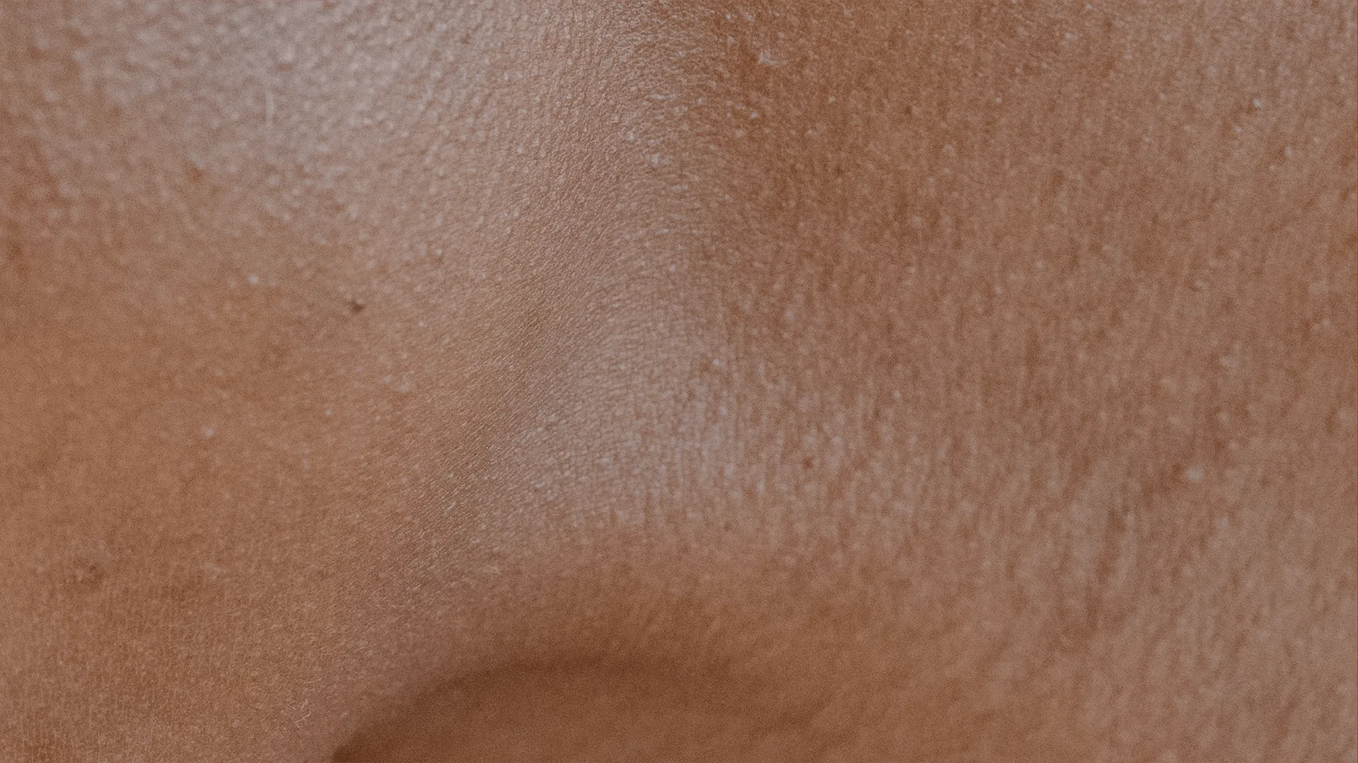 Close-up of natural skin for contacting Natalia Mejia about scar camouflage and paramedical tattoo care in New York