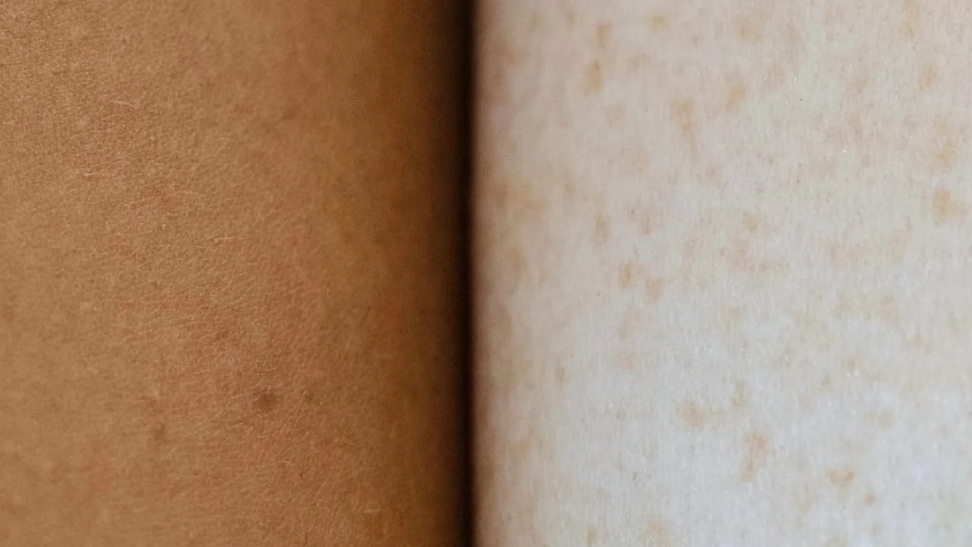 Close-up of two skin tones meeting at a soft fold, beside answers about scar camouflage, areola tattooing, and stretch mark care
