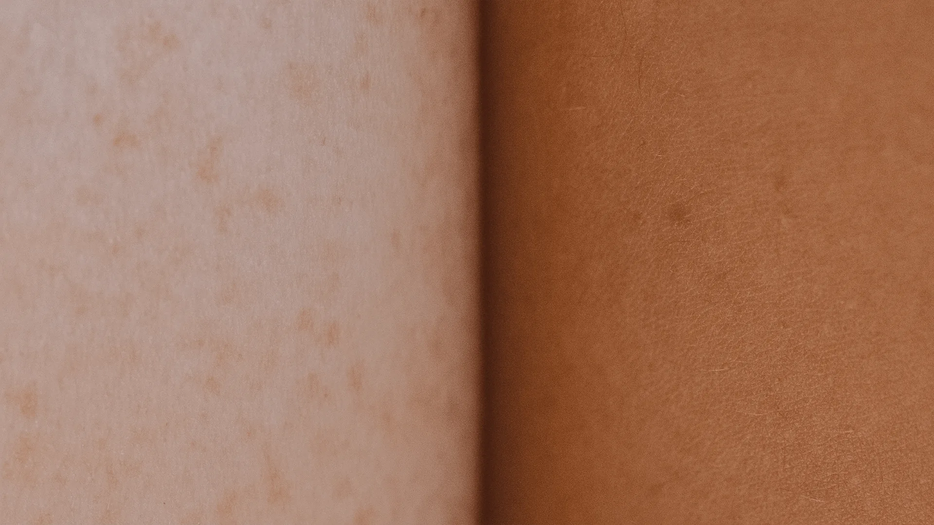 Close-up of natural skin texture accompanying answers about scar camouflage, areola tattooing, and stretch mark care